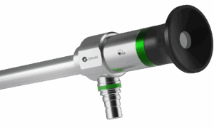 AlphaSMART_AlphaScope_Laparoscope